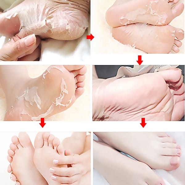 Jaysuing Exfoliating Foot Mask قناع تقشير القدمين جاي سوينغ - Image 2