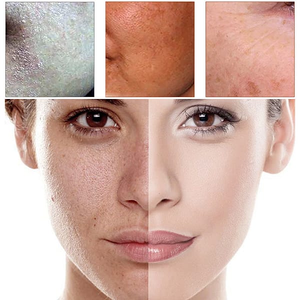 After sun Vitamin B5 essence سيروم فيتامين ب5 بعد التعرض للشمس - Image 2