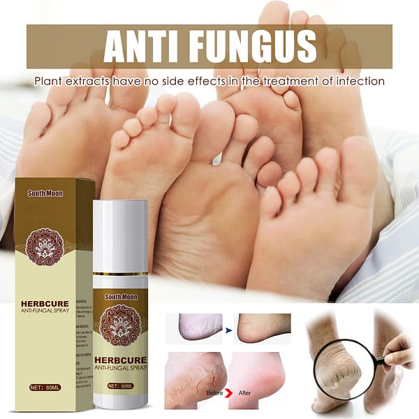 Herbecure Herbal anti fungal Spray هيربكيور لقدم الرياضي