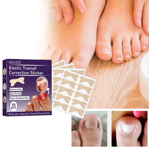 Eelhoe Toenail Correction Patch لاصقات تصحيح الظفر المغروس