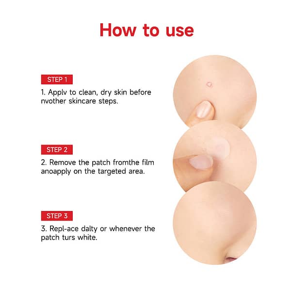 Acne Pimple Master Patch لصقات حب الشباب - Image 2