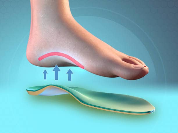 Arch Support